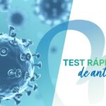 Test rápidos de antígenos COVID-19: una herramienta para detectar posibles contagios